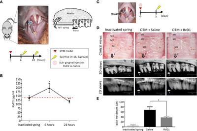 Resolvin D1 shows osseous-protection via RANK reduction on monocytes during <mark class="highlighted">orthodontic tooth movement</mark>